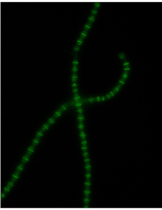 Desvelando elementos que conectan procesos cianobacterianos esenciales. 
Interactions of PatA with the Divisiome during Heterocyst Differentiation in Anabaena.