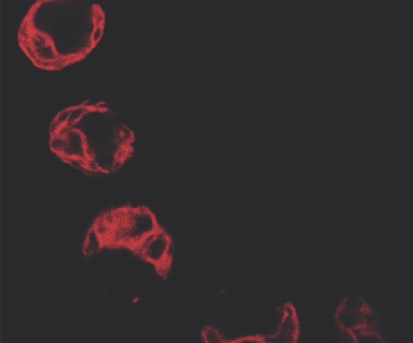 Chloroplast Damage Induced by the Inhibition of Fatty Acid Synthesis Triggers Autophagy in Chlamydomonas